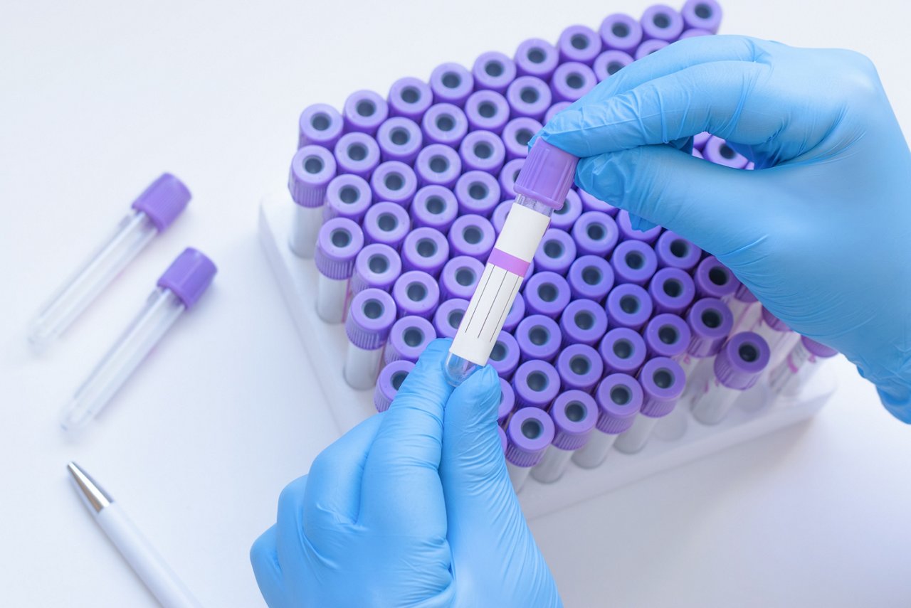 Hands in blue medical gloves holding an empty blood donation tube; Shutterstock ID 2758196261; purchase_order: OPP Website & Collateral; job: ; client: ; other: 